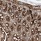 Alanyl-TRNA Synthetase 2, Mitochondrial antibody, HPA035636, Atlas Antibodies, Immunohistochemistry frozen image 