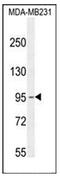 Potassium Sodium-Activated Channel Subfamily T Member 2 antibody, AP52320PU-N, Origene, Western Blot image 