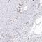 SH3 And PX Domains 2B antibody, PA5-57673, Invitrogen Antibodies, Immunohistochemistry frozen image 