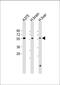 Delta Like Canonical Notch Ligand 3 antibody, A05871-1, Boster Biological Technology, Western Blot image 
