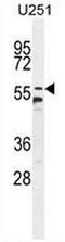 Coiled-Coil Domain Containing 9 antibody, AP50796PU-N, Origene, Western Blot image 