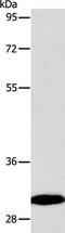 Carbonic Anhydrase 3 antibody, TA322661, Origene, Western Blot image 