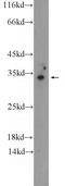 OTU Deubiquitinase 6A antibody, 24486-1-AP, Proteintech Group, Western Blot image 