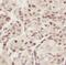 Elongin C antibody, FNab08548, FineTest, Immunohistochemistry paraffin image 