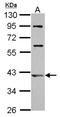 ADP Ribosylation Factor Like GTPase 13B antibody, NBP2-15463, Novus Biologicals, Western Blot image 