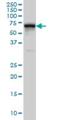 RNA Binding Motif Protein 39 antibody, H00009584-M01, Novus Biologicals, Western Blot image 