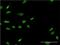 LIM/homeobox protein Lhx6 antibody, H00026468-M02, Novus Biologicals, Immunocytochemistry image 