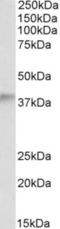 Alcohol Dehydrogenase 5 (Class III), Chi Polypeptide antibody, NB100-57101, Novus Biologicals, Western Blot image 