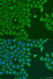 POP7 Homolog, Ribonuclease P/MRP Subunit antibody, 23-449, ProSci, Immunofluorescence image 