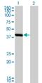 Spermine Synthase antibody, H00006611-M01, Novus Biologicals, Western Blot image 