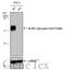 Eukaryotic Translation Initiation Factor 4E Binding Protein 1 antibody, GTX133182, GeneTex, Western Blot image 