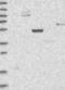 Menin 1 antibody, NBP1-90357, Novus Biologicals, Western Blot image 