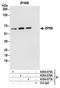 Zinc Finger Protein 622 antibody, A304-077A, Bethyl Labs, Immunoprecipitation image 