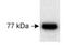 Fermitin Family Member 1 antibody, NB100-523, Novus Biologicals, Western Blot image 