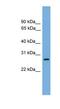 ATP Synthase Mitochondrial F1 Complex Assembly Factor 1 antibody, NBP1-56969, Novus Biologicals, Western Blot image 