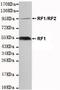 Paternally Expressed 10 antibody, ab131194, Abcam, Western Blot image 