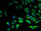 Cytochrome B5 Reductase 3 antibody, A51645-100, Epigentek, Immunofluorescence image 