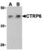 C1q And TNF Related 6 antibody, A12414, Boster Biological Technology, Western Blot image 