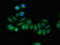 Regulator Of Calcineurin 2 antibody, LS-C679302, Lifespan Biosciences, Immunofluorescence image 