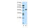 Zinc Finger Protein 213 antibody, 28-867, ProSci, Western Blot image 