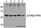Estrogen Receptor 2 antibody, A00786S105, Boster Biological Technology, Western Blot image 