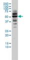 Cyclase Associated Actin Cytoskeleton Regulatory Protein 2 antibody, H00010486-M01, Novus Biologicals, Western Blot image 