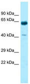 Keratin 9 antibody, TA338384, Origene, Western Blot image 