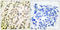 Transcription Factor Dp-1 antibody, LS-C118433, Lifespan Biosciences, Immunohistochemistry paraffin image 