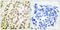 TFDP1 antibody, LS-C118433, Lifespan Biosciences, Immunohistochemistry paraffin image 