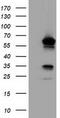 T-Complex 11 Like 2 antibody, CF501807, Origene, Western Blot image 