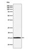 Ubiquitin Conjugating Enzyme E2 N antibody, M02462-1, Boster Biological Technology, Western Blot image 