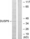 Dual Specificity Phosphatase 9 antibody, LS-B8431, Lifespan Biosciences, Western Blot image 