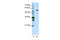 Cleavage And Polyadenylation Specific Factor 7 antibody, ARP41012_T100, Aviva Systems Biology, Western Blot image 