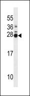 MOB Kinase Activator 3B antibody, LS-C164270, Lifespan Biosciences, Western Blot image 