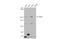 Tet Methylcytosine Dioxygenase 2 antibody, GTX124205, GeneTex, Western Blot image 