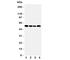Solute Carrier Family 16 Member 4 antibody, R31311, NSJ Bioreagents, Western Blot image 