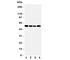 Monocarboxylate transporter 5 antibody, R31311, NSJ Bioreagents, Western Blot image 