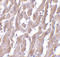 MYD88 Innate Immune Signal Transduction Adaptor antibody, PM-4673, ProSci, Immunohistochemistry paraffin image 