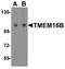 Anoctamin 2 antibody, A04801, Boster Biological Technology, Western Blot image 