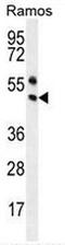 Paired Box 5 antibody, AP53179PU-N, Origene, Western Blot image 