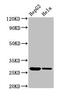 Vacuolar protein sorting-associated protein 29 antibody, CSB-PA890661LA01HU, Cusabio, Western Blot image 