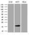 Anterior Gradient 2, Protein Disulphide Isomerase Family Member antibody, LS-C792225, Lifespan Biosciences, Western Blot image 
