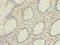 Heterogeneous Nuclear Ribonucleoprotein L antibody, A59398-100, Epigentek, Immunohistochemistry paraffin image 