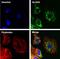 Aldehyde Dehydrogenase 2 Family Member antibody, MA5-17029, Invitrogen Antibodies, Immunofluorescence image 