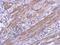 Cartilage Acidic Protein 1 antibody, GTX119558, GeneTex, Immunohistochemistry paraffin image 