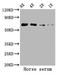 Albumin antibody, LS-C210769, Lifespan Biosciences, Western Blot image 