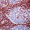 CD5 Molecule antibody, MA5-14560, Invitrogen Antibodies, Immunohistochemistry frozen image 