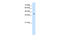 Tetraspanin 12 antibody, 30-248, ProSci, Western Blot image 