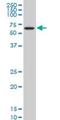 Iroquois Homeobox 3 antibody, H00079191-M05, Novus Biologicals, Western Blot image 