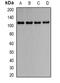 Oncostatin M Receptor antibody, abx142119, Abbexa, Western Blot image 